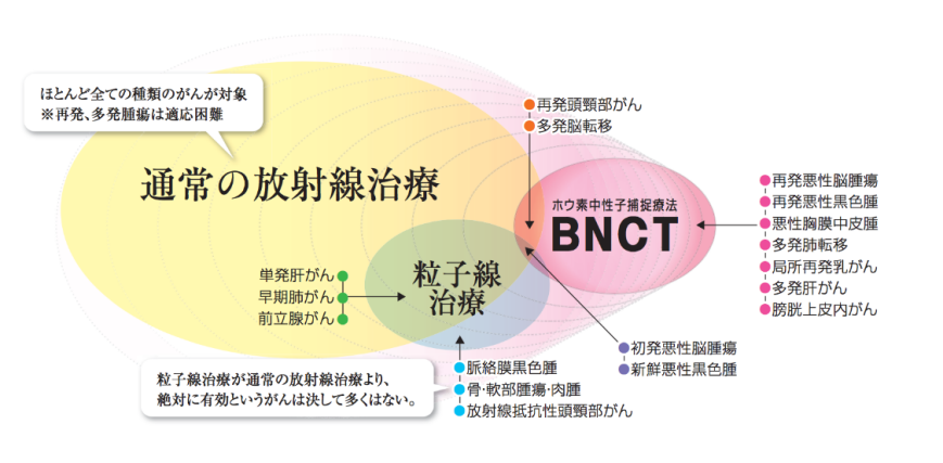 深入了解！！“硼中子俘获疗法（BNCT）”的原理和常见问题，探索癌症治疗的新方向！