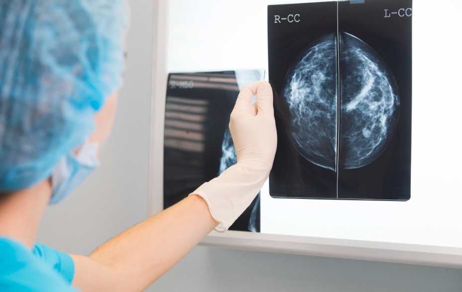 全面解读，治疗乳腺癌：选择保乳手术还是全切手术？
