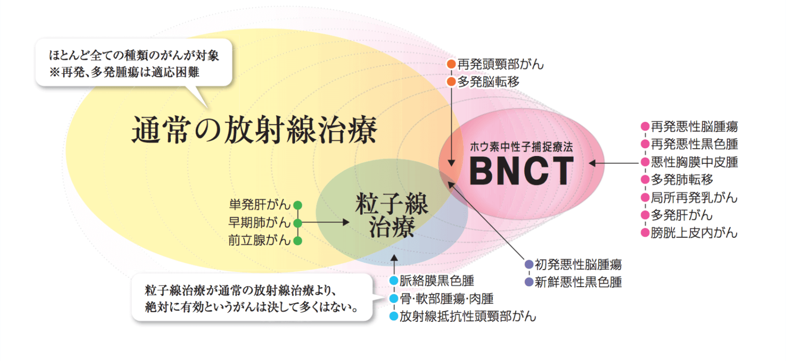 硼中子俘获疗法