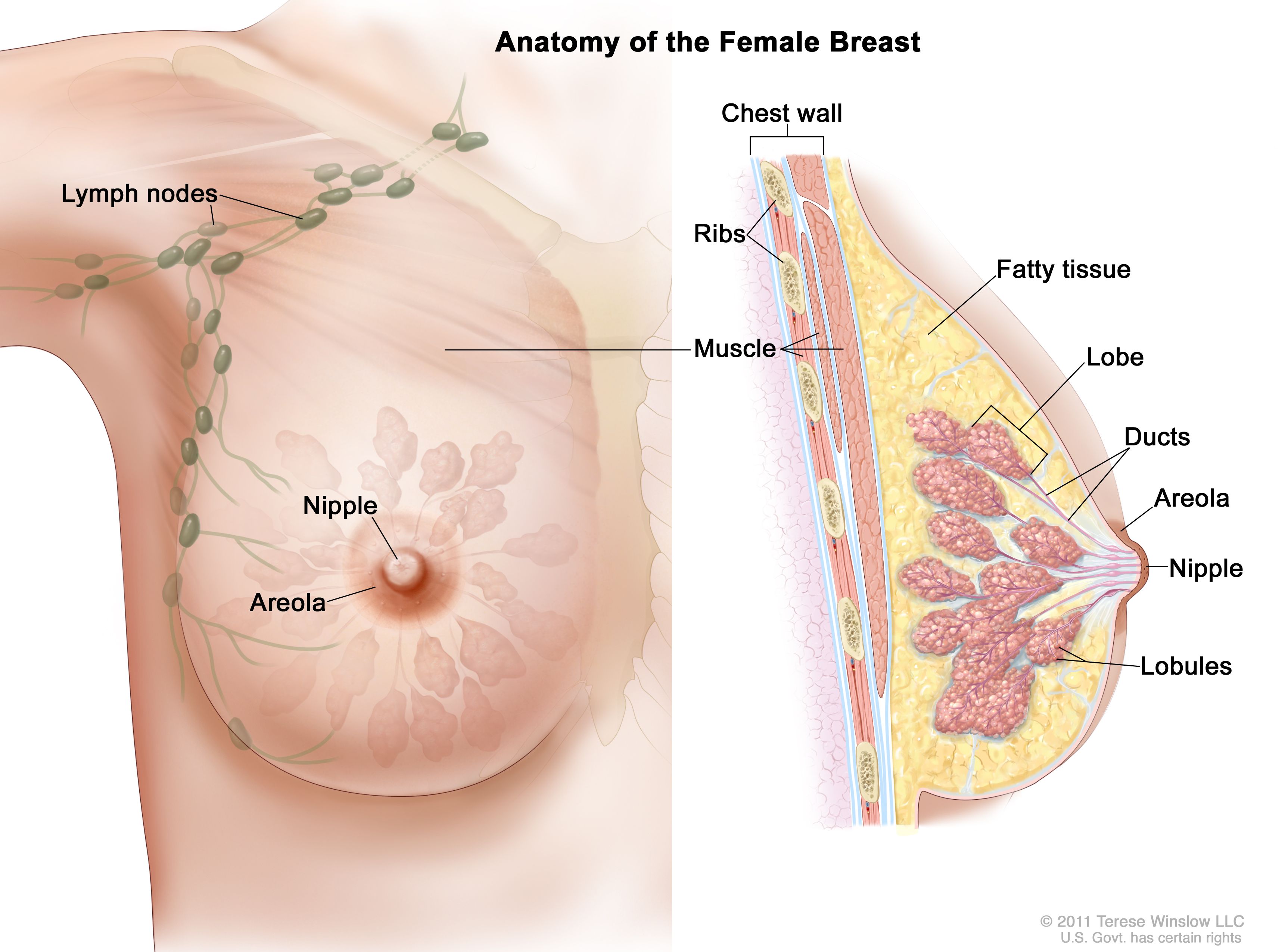 乳腺癌