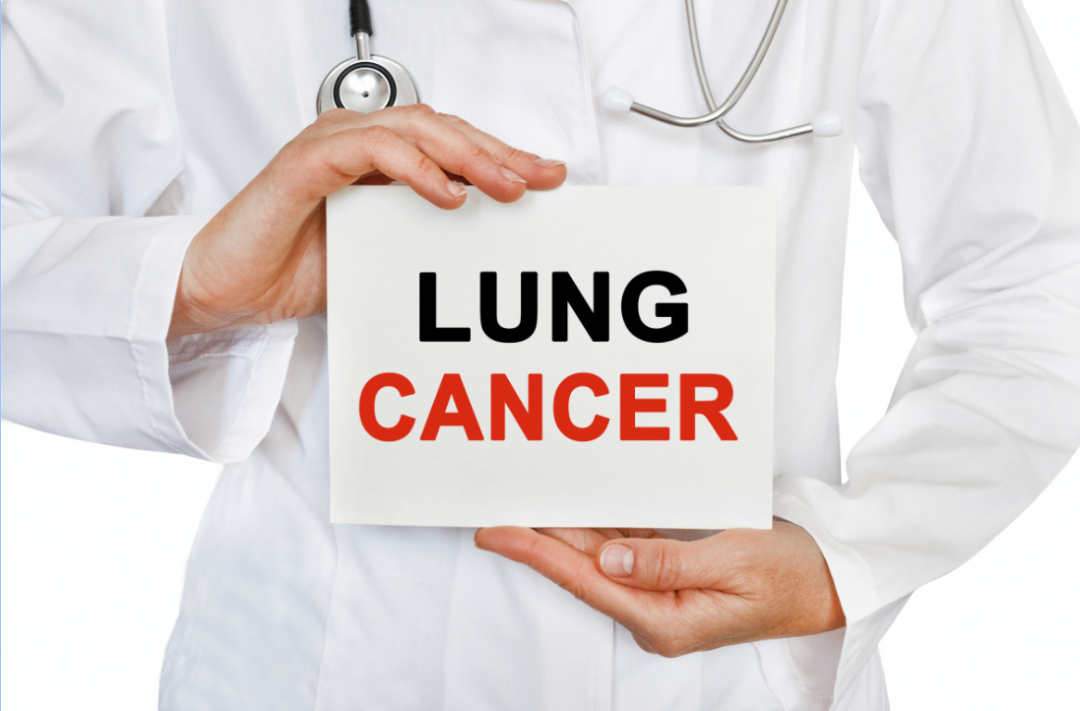 关于肺癌 || 吸烟是导致肺癌的主要原因吗？如何预防肺癌？