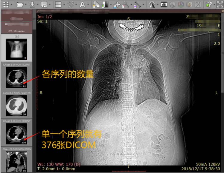 什么是DICOM格式医学影像？如何获取？