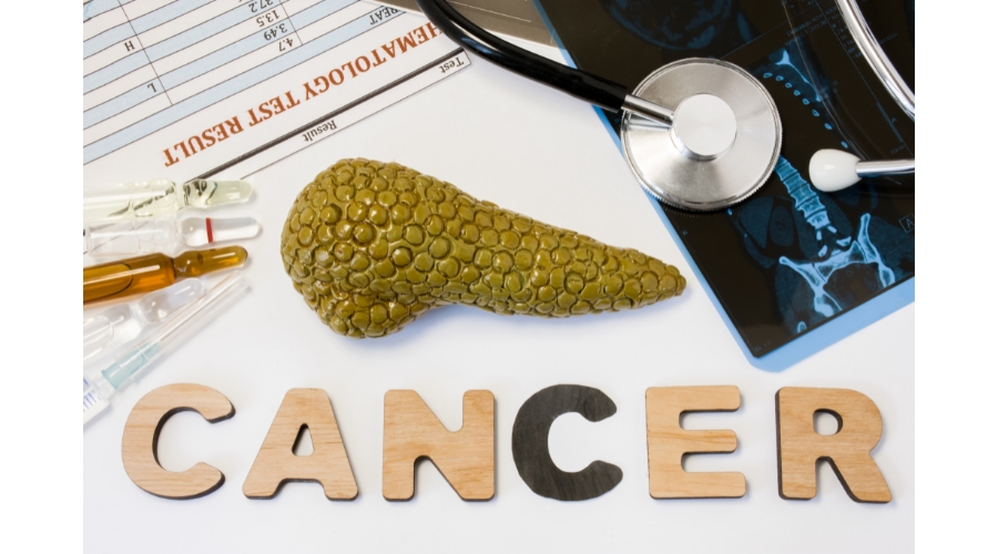 “癌中之王”——胰腺癌选择手术还是重离子？