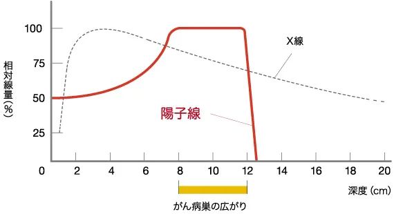 质子治疗