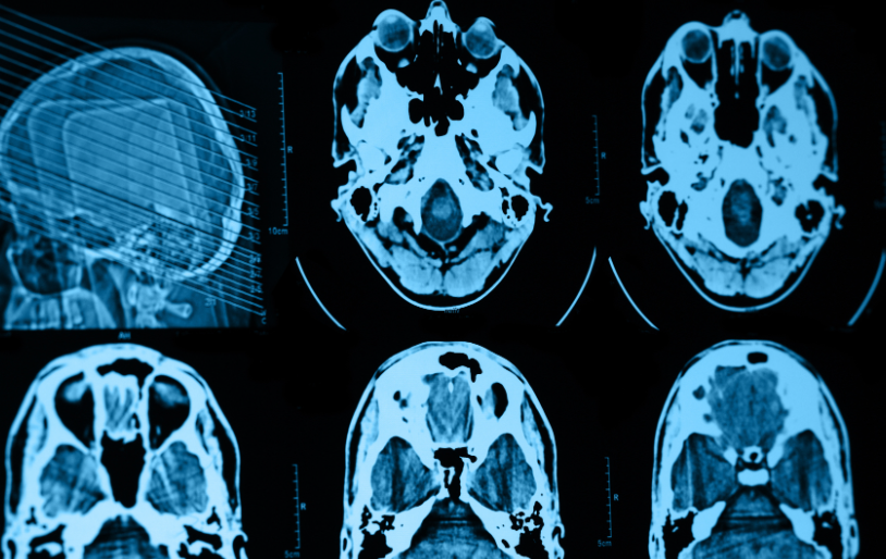 医院拍片子辐射量到底多大？ B超、X光、CT、MRI 关于影像学检查的真相在这里