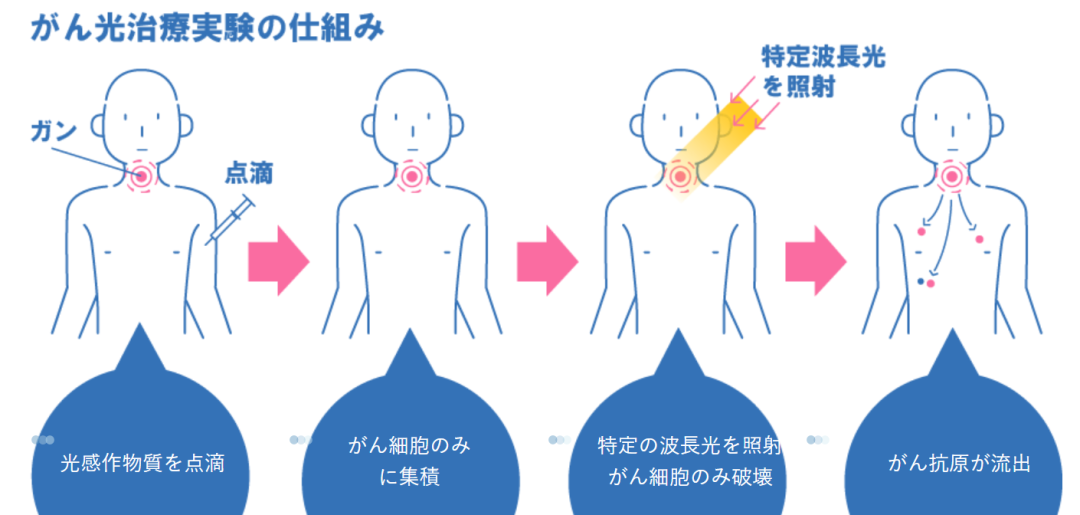 抗癌“黑科技”-光免疫疗法，适合治疗哪些类型的癌症？