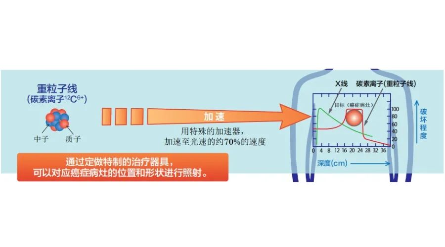 日本 “重离子治疗权威医院” —群马大学医学部附属医院重离子医学中心