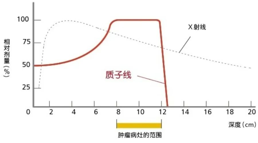 "质子治疗"国际标准诞生地——筑波大学附属医院质子治疗中心