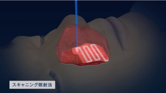 日本先进的质子治疗中心—【国立癌症研究中心东医院】