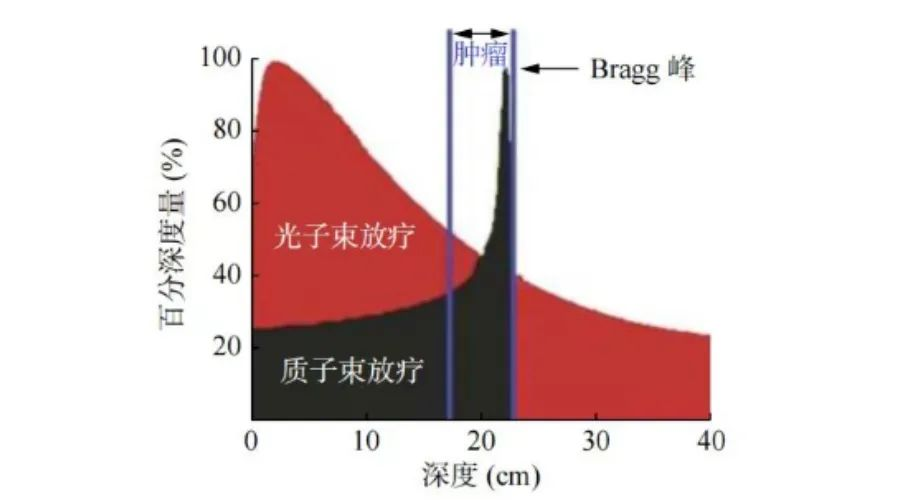 什么是生殖细胞肿瘤？质子治疗的优势在哪里？