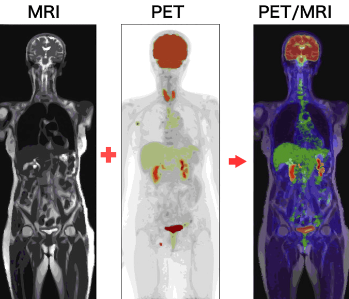 MRI-PET