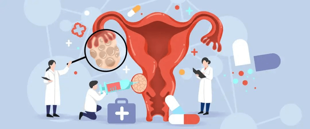 卵巢癌-可愈有道