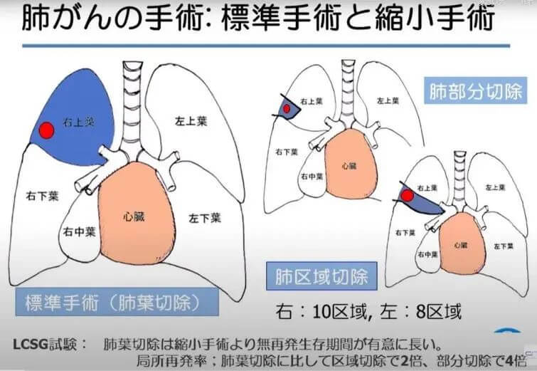 坪井正博-可愈有道