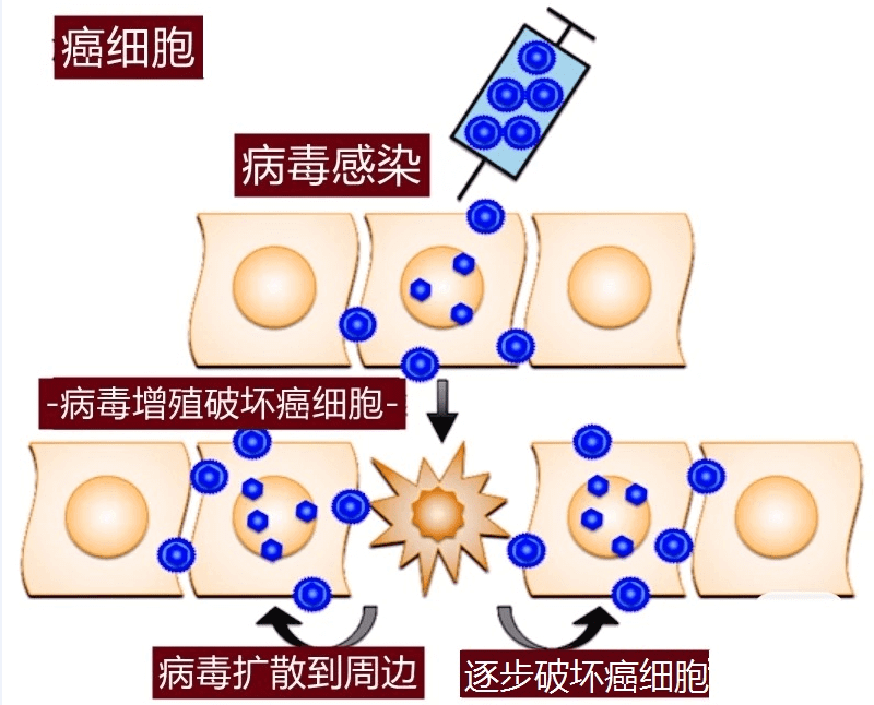 病毒