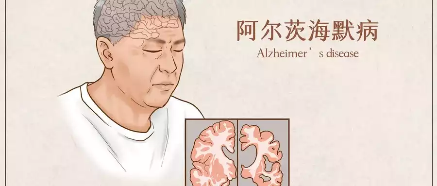 世界阿尔茨海默病日