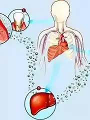 慢性炎症：癌症的“隐形导火索”与科学防范