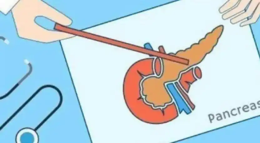 胰腺癌：肿瘤能否停止生长