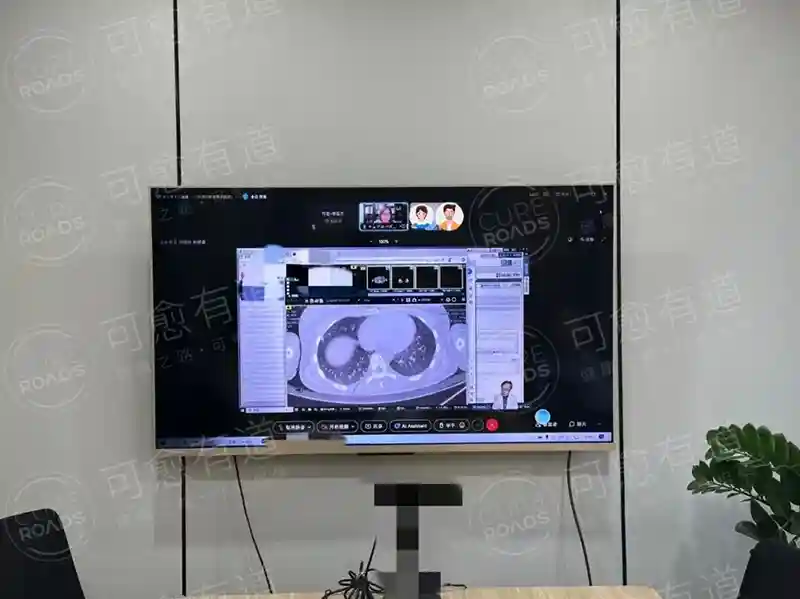 高桥教授视频会诊