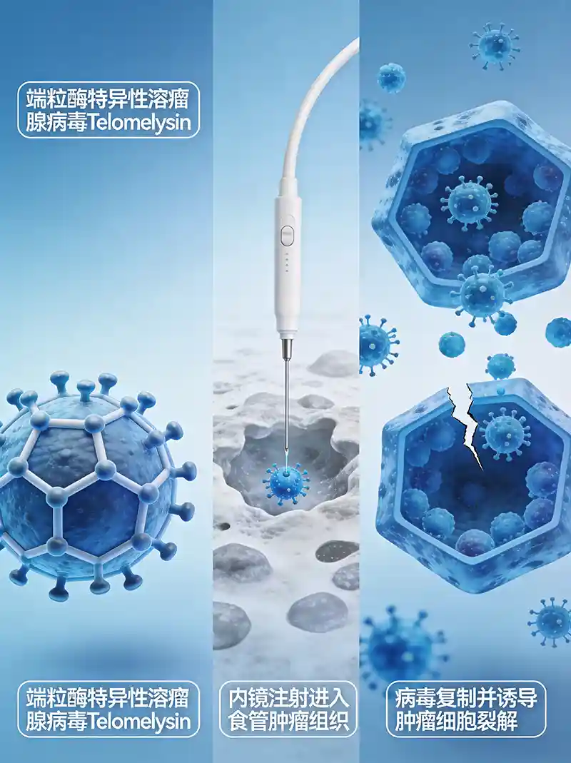 可愈有道_出国看病_食管癌首款溶瘤腺病毒Telomelysin日本获批：溶瘤病毒疗法迎来里程碑突破
