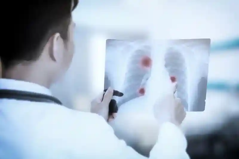 医生看X光片 医生看X光片